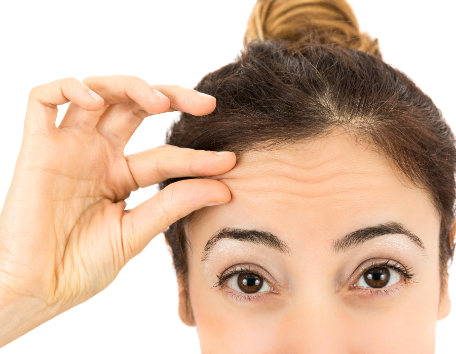 Profhilo treatment London