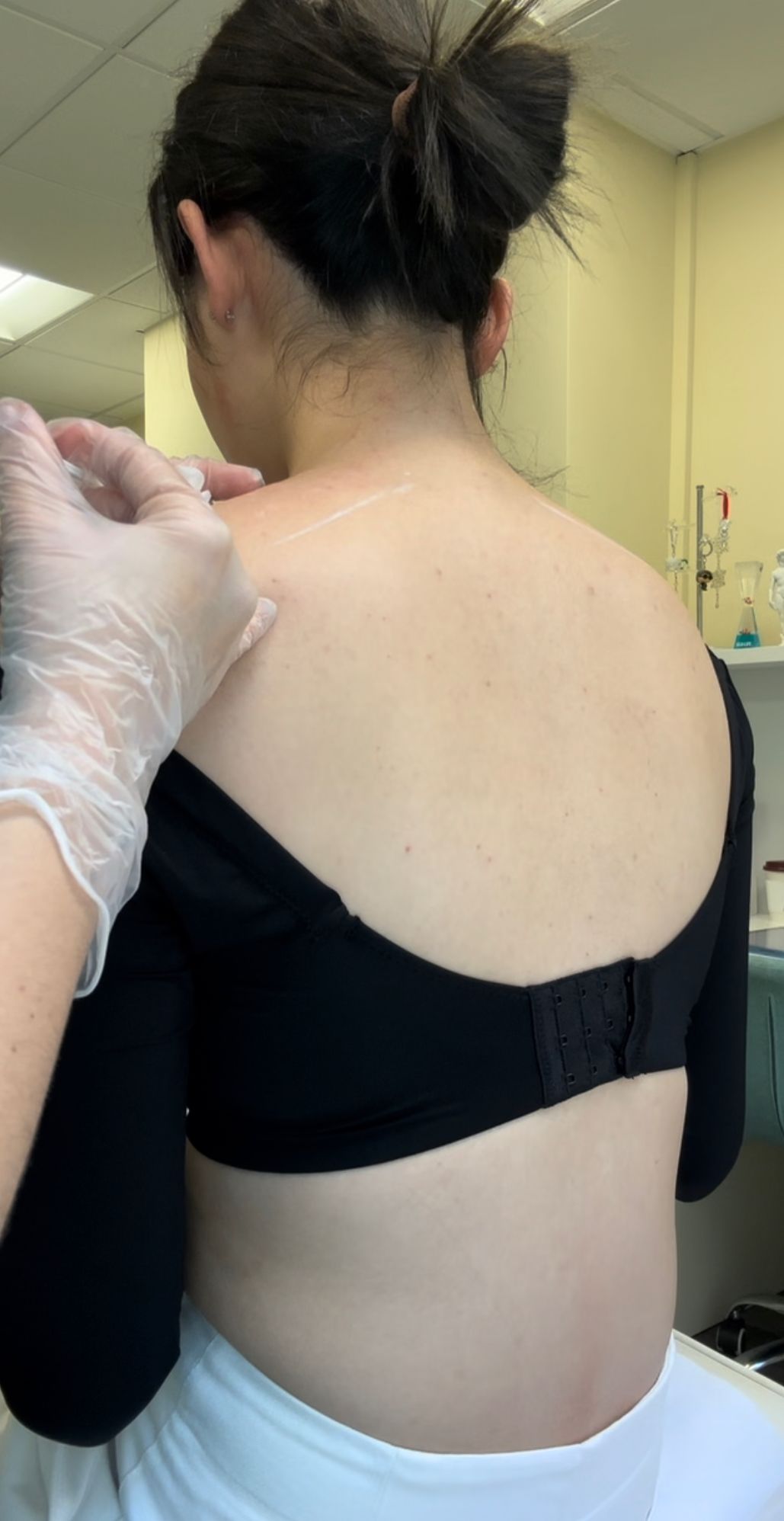 shoulder, calf and arm slimming